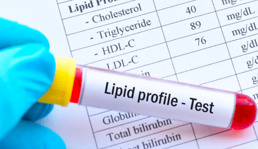 Lipid Profile Test