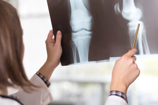 Joint & Bone Check-Up Package